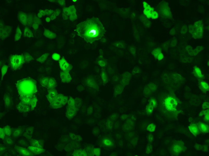 A549-GFP Cell Complete Medium - 2