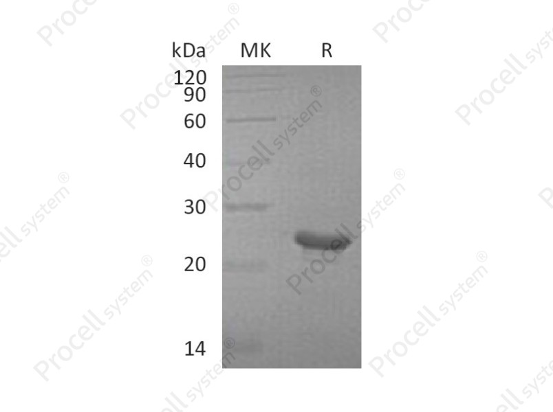 FGF-21/FGFL, Human, Recombinant