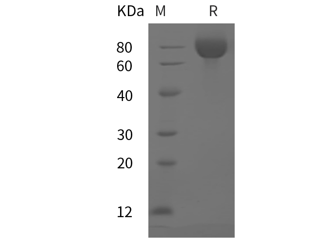 Recombinant Mouse ALCAM/CD166 Protein(His Tag)-1