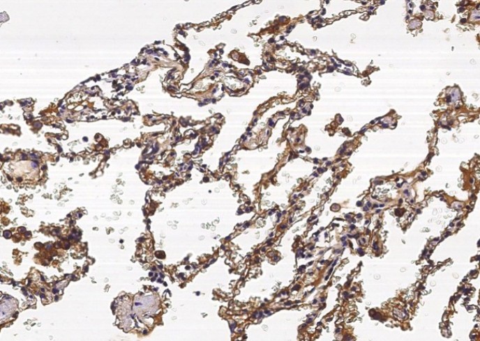 S100A10 Monoclonal Antibody - small - 4