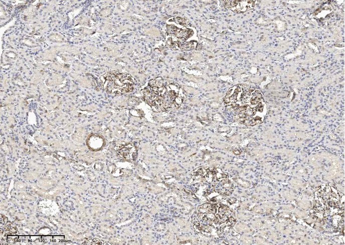 Recombinant Vimentin Monoclonal Antibody - small - 3