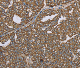CERS4 Polyclonal Antibody - 2