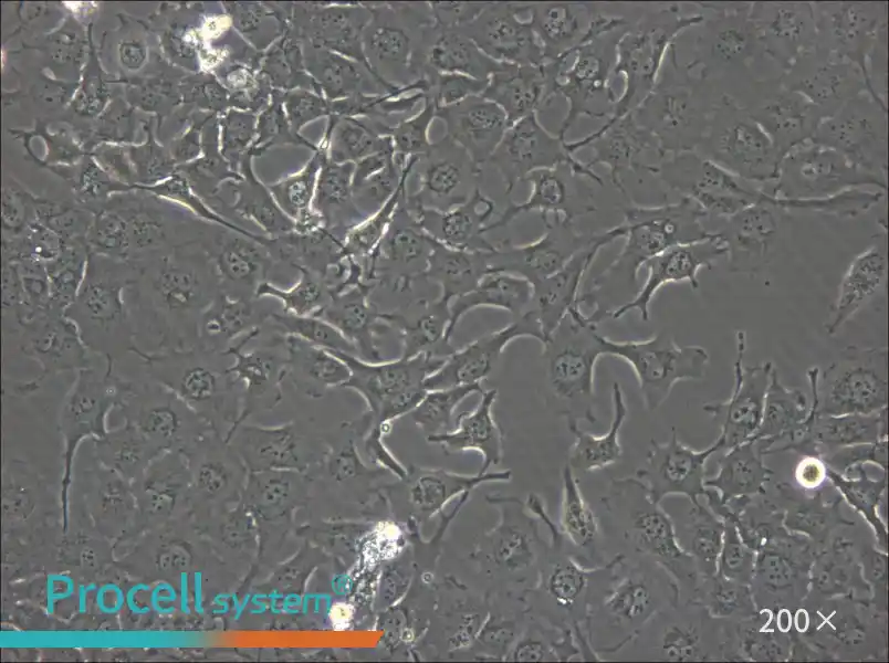 BT-549 Cell Complete Medium - small - 5