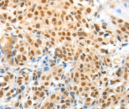 APPL1 Polyclonal Antibody - 2