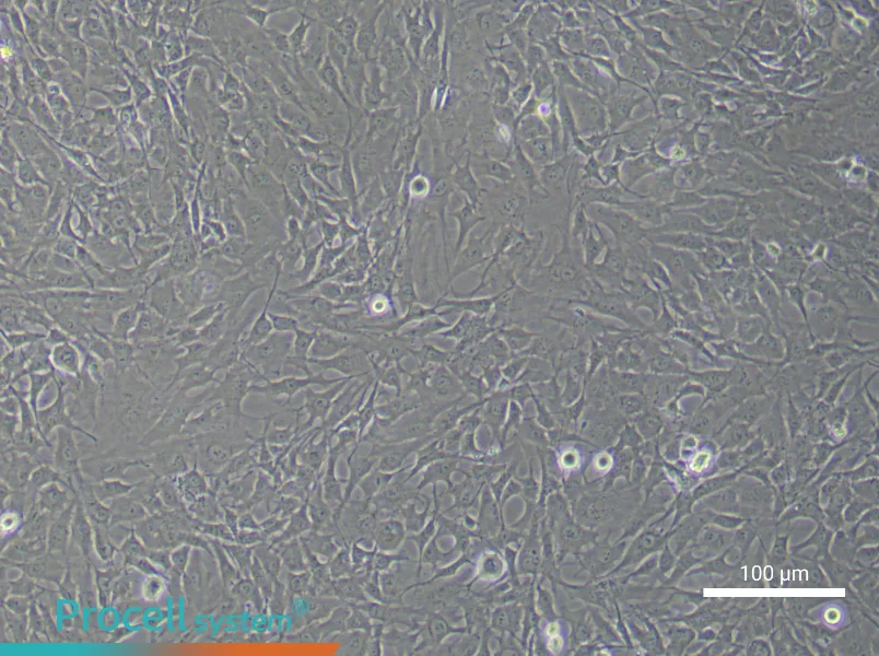 Human Chondrocyte (Primary cell immortalization) Complete Medium - 1