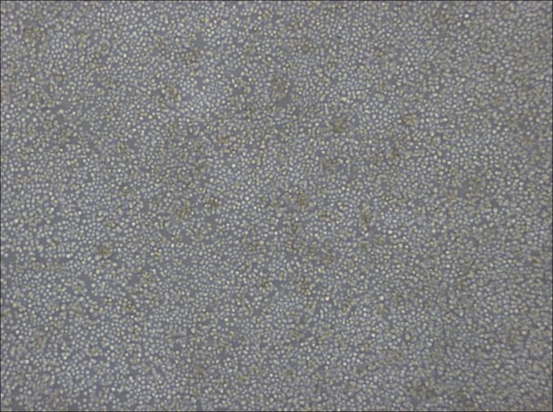 DoHH2 Cell Complete Medium-searchlist-1