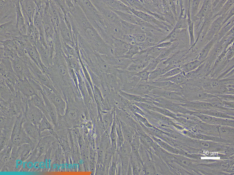 Human Esophageal Fibroblast Complete Medium - 5