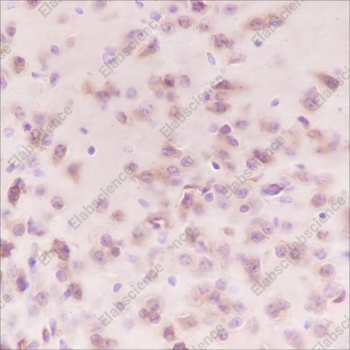 Recombinant Stathmin Monoclonal Antibody - 4