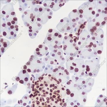 Recombinant Phospho-Cyclin D1 (Thr286) Monoclonal Antibody - 4