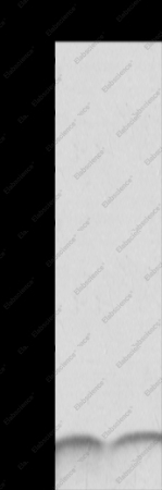 S100A6 Polyclonal Antibody - 1