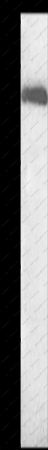 ALB Polyclonal Antibody - 1