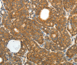 PRDX3 Polyclonal Antibody - 3