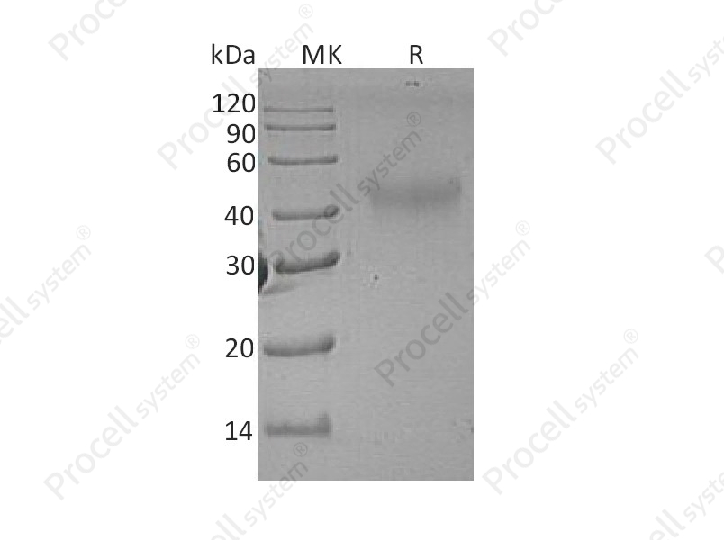 M-CSF/CSF1, Rat, Recombinant