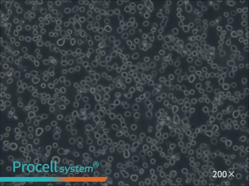 Karpas-299 Cell Complete Medium - 5