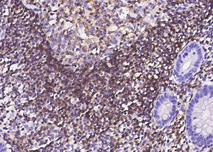 Recombinant Ly108/SLAMF6 Monoclonal Antibody - small - 3