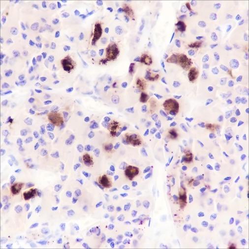 Recombinant Luteinizing Hormone beta Monoclonal Antibody - 2