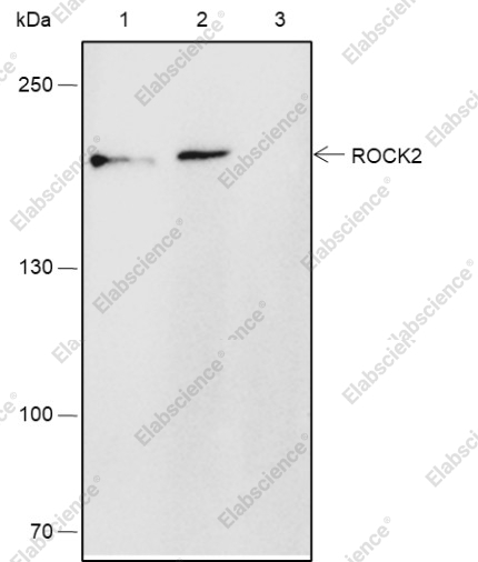 Recombinant ROCK2 Monoclonal Antibody - 5