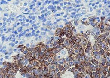 Recombinant AID Monoclonal Antibody-searchlist-2