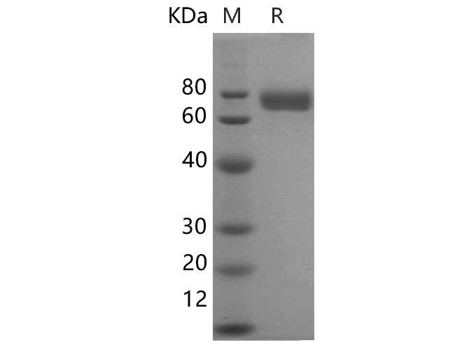 Recombinant Human sCD163 Protein(His Tag)-产品推荐-1