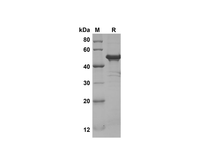 Recombinant Mouse IL-5 Protein-产品推荐-1