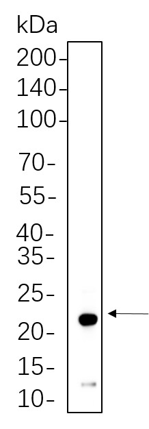 Recombinant NDUFB8 Monoclonal Antibody-searchlist-1