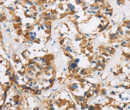 COX6B1 Polyclonal Antibody - 2