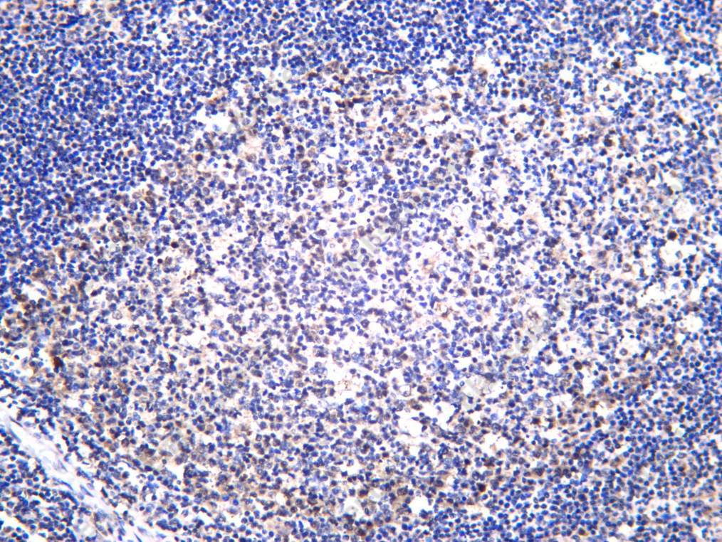 Recombinant Dyskerin Monoclonal Antibody - 2