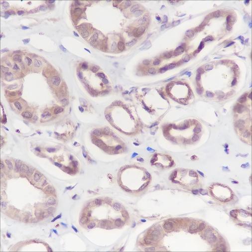 Recombinant Calpain small subunit 1 Monoclonal Antibody-searchlist-1