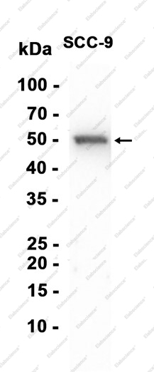 Recombinant Keratin 17 Monoclonal Antibody - 1