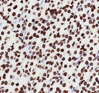Recombinant Histone H4 (CT) Monoclonal Antibody - small - 6