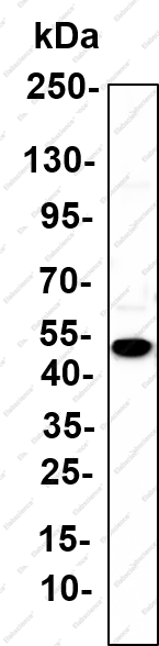 Recombinant AAT Monoclonal Antibody - 1