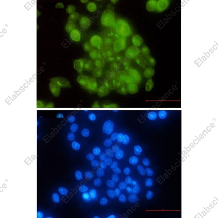 Recombinant BUBR1 Monoclonal Antibody - 3