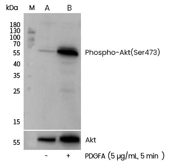 Recombinant Phospho-AKT (Ser473) Monoclonal Antibody - small - 5