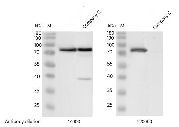 Recombinant Phospho-PKCα (Thr638) Monoclonal Antibody - small - 2