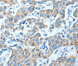 ALDH4A1 Polyclonal Antibody - 3