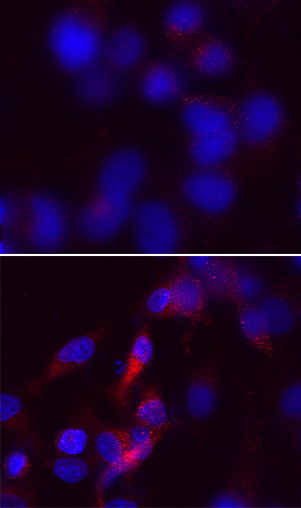 Recombinant SQSTM1/p62 Monoclonal Antibody - small - 7