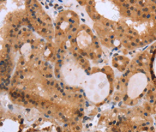 EPDR1 Polyclonal Antibody - 3