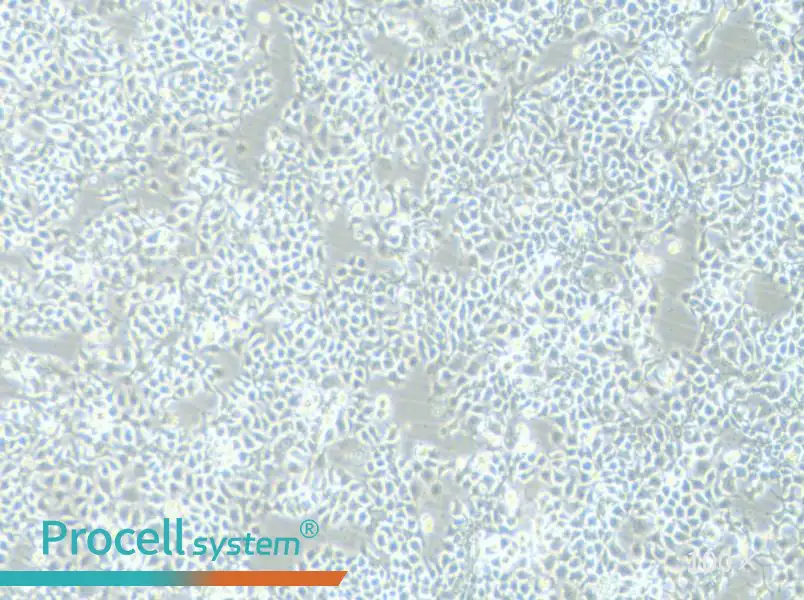KYSE-180 Cell Complete MediumKYSE-180 Cell Complete Medium - 3