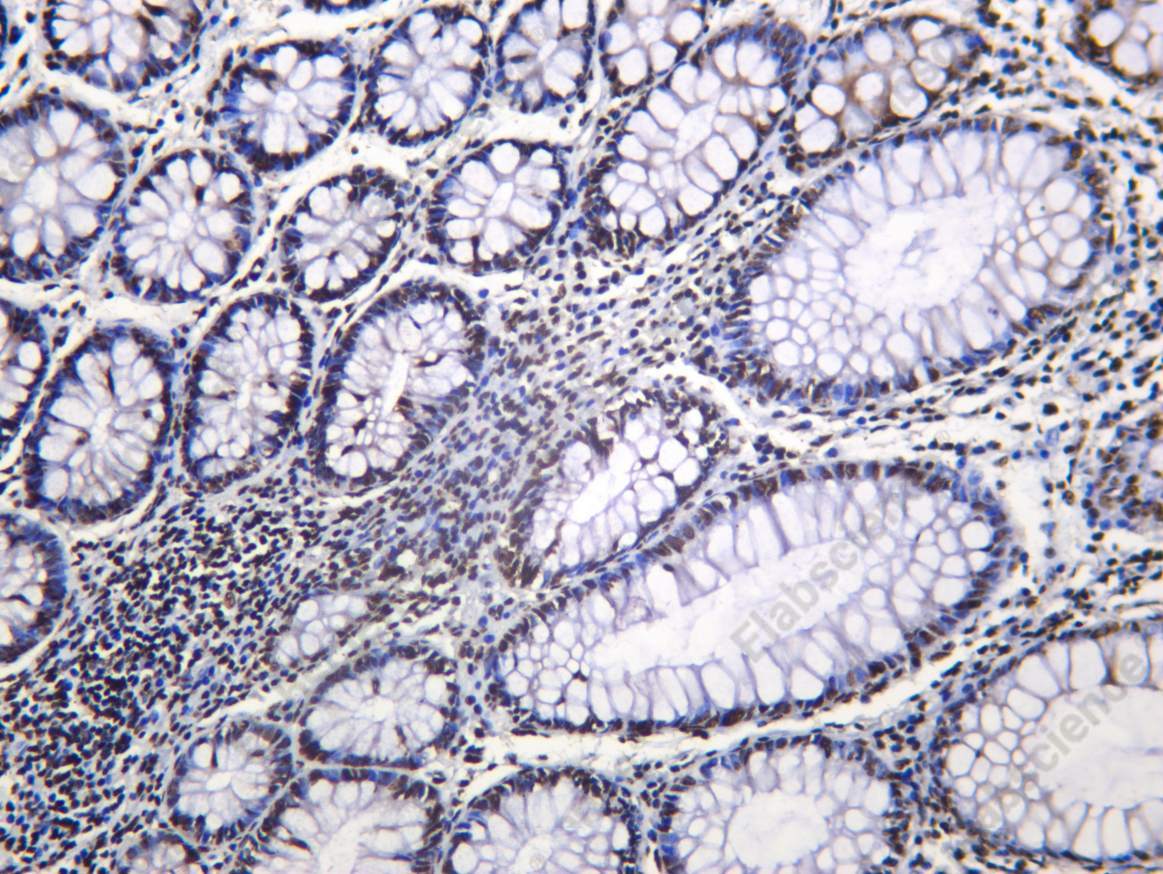 Recombinant NF90 Monoclonal Antibody - 1