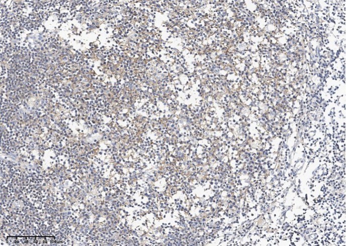 CD19 Monoclonal Antibody - small - 2