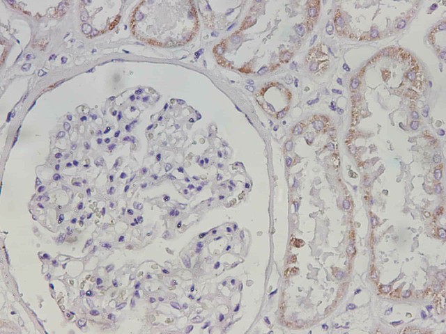 Purified Anti-Human CD38 Antibody[HIT2]-产品推荐-1
