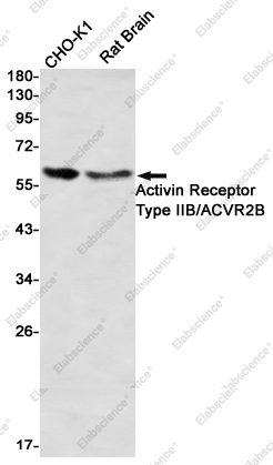 Recombinant Activin Receptor Type IIB Monoclonal Antibody - 1