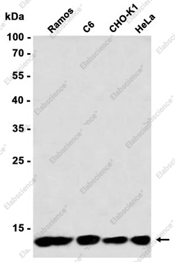 Recombinant RPS20 Monoclonal Antibody - 1