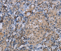 CDC16 Polyclonal Antibody - 2