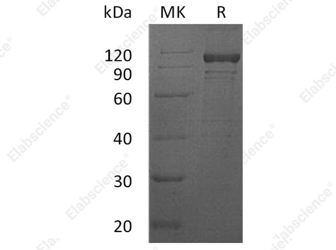Recombinant Human IL12RB1 Protein (Fc Tag) - 1