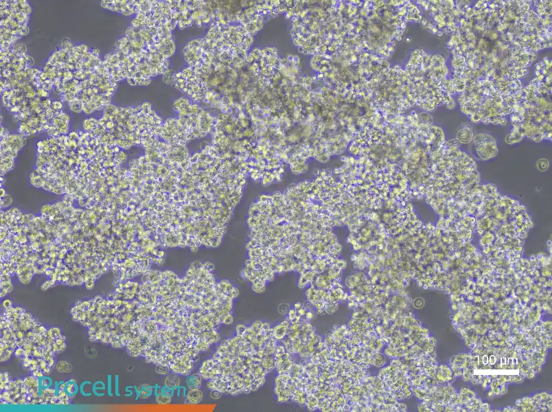 NCI-H187NCI-H187 - 2