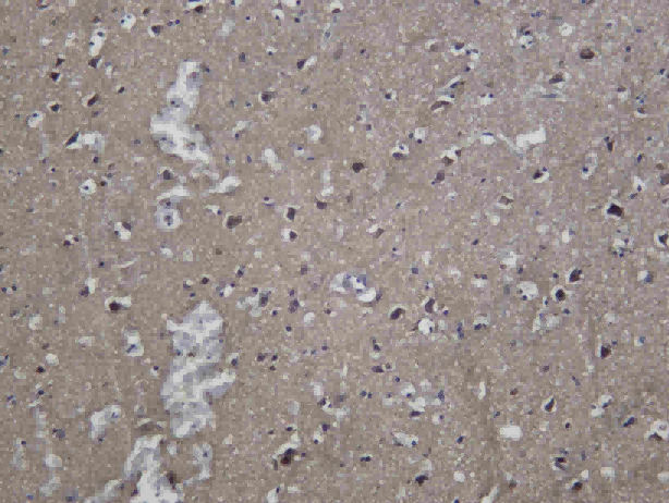Recombinant Presenilin 1 Monoclonal Antibody - 1