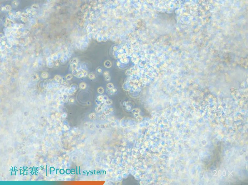 NCI-H2171（人肺癌细胞）-细胞系-武汉普诺赛生命科技有限公司