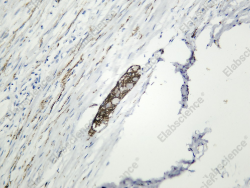 Recombinant CD56 Monoclonal Antibody - 1