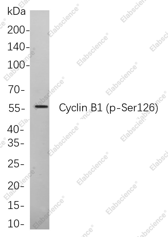 Recombinant Phospho-Cyclin B1 (Ser126) Monoclonal Antibody - 1